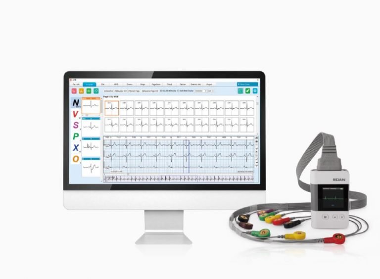 ECG Holtor System