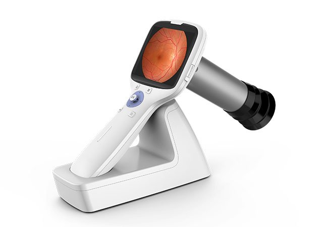 Fundus Camera
