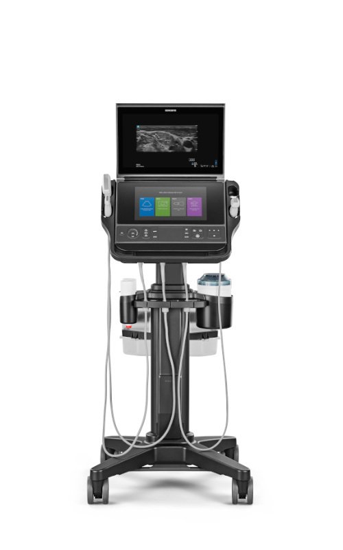 Portable ultrasound system