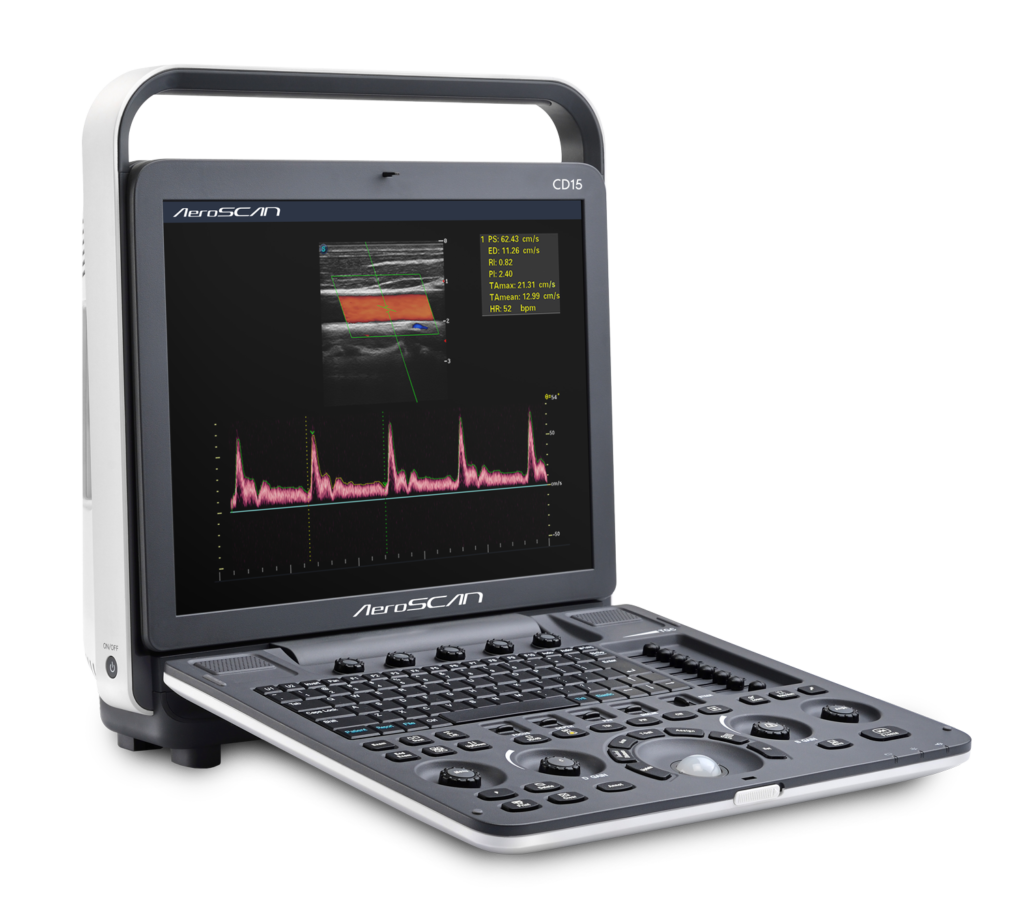 Portable ultrasound colour system