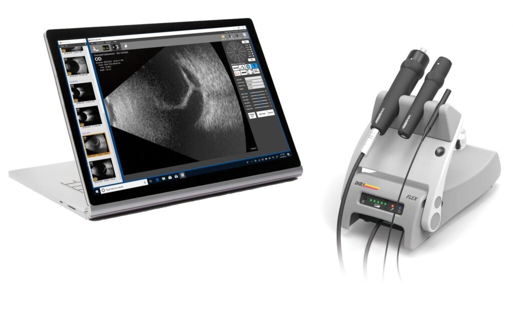 Ultrasound A/B Scan